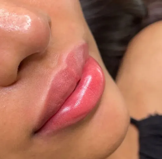 Lip neutralization for dark lips at VietBeautyHub