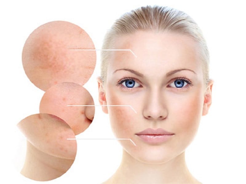 Gros plan des variations de texture de la peau.